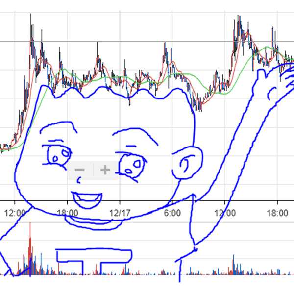 시계열 데이터를 분석하여 미래 예측(Anomaly Detection)